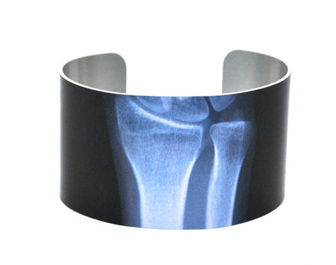 X-Ray of Wrist Aluminium Cuff